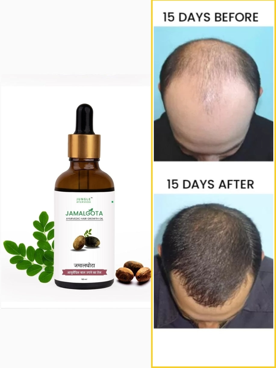 Jamalghota Hair Growth Oil (Each 30ml) buy 1 get 1 free